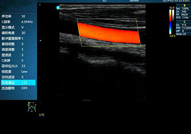 DR体检车 DR体检车