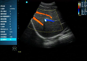 DR体检车 DR体检车